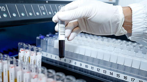 科学技术发展基金资助26项新型冠状病毒感染科研项目助力技术开发